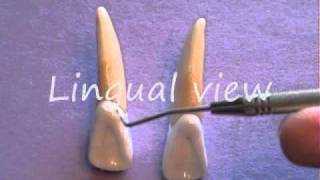 Maxillary Lateral Incisor Anatomy