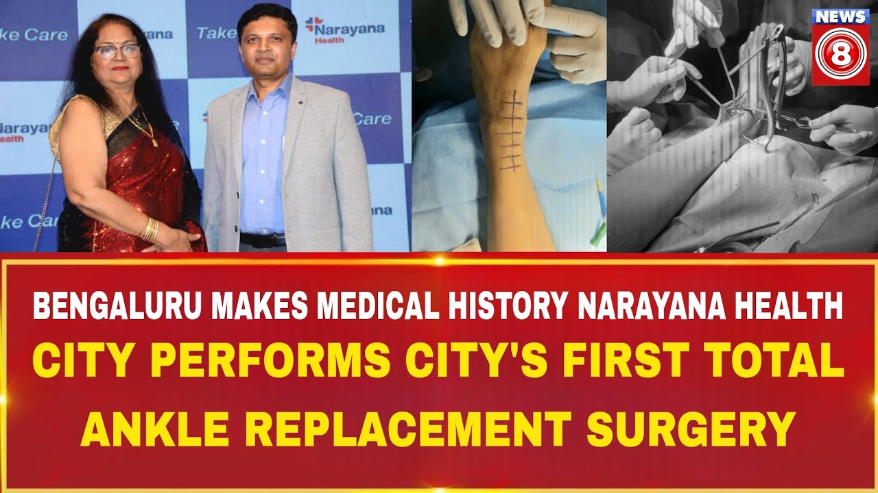 Bengaluru Makes Medical History Narayana Health Performs Citys First Total Ankle Replacement Surgery