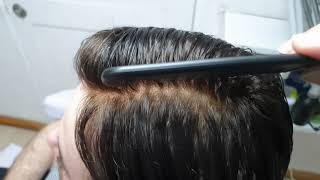 Prótesis Capilares indetectables Ra Costa Rica