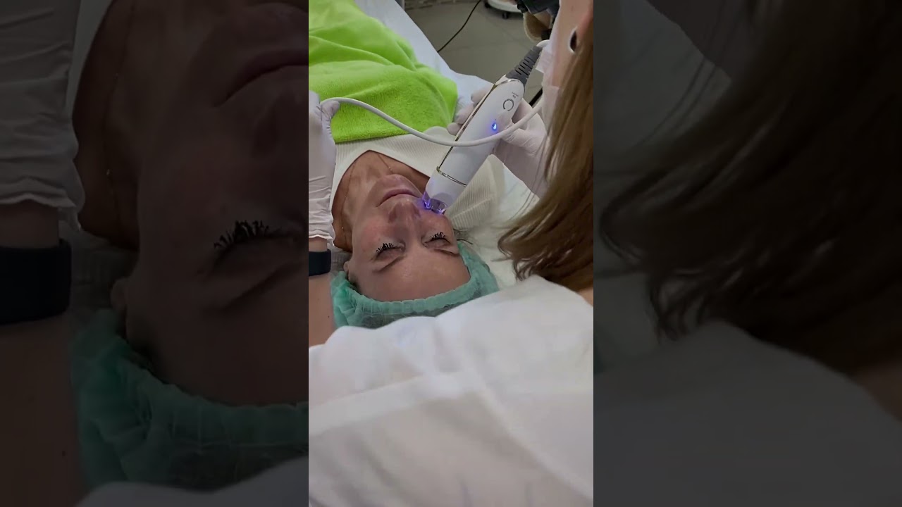 Аппарат 5 в 1 Hello Face: трансдермальная мезотерапия, EMS Clip, RF-лифтинг, криотерапия