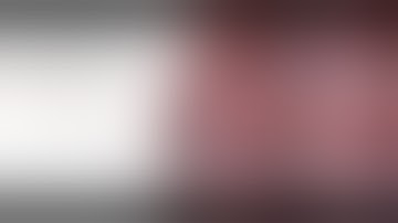 Lap Repair (TAPP) of an inguinal hernia using PROGRIP mesh. Mr Suhail Anwar