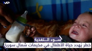 تفاقم مرض سوء التغذية عند الأطفال في مخيمات شمال سوريا والسبب الفقر وغلاء الأسعار