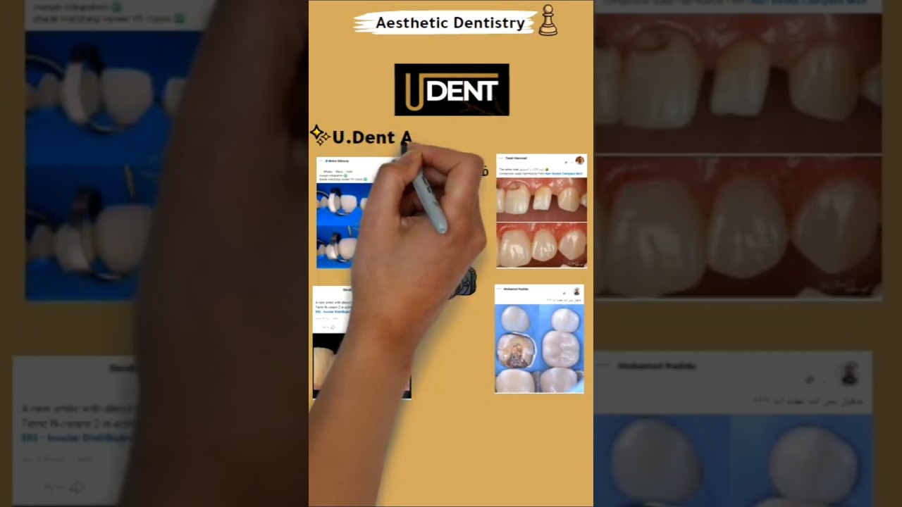 اسأل على تفاصيل حجز U.Dent Aesthetic Summit  فرصة روعة متضيعهاش🔥👀 