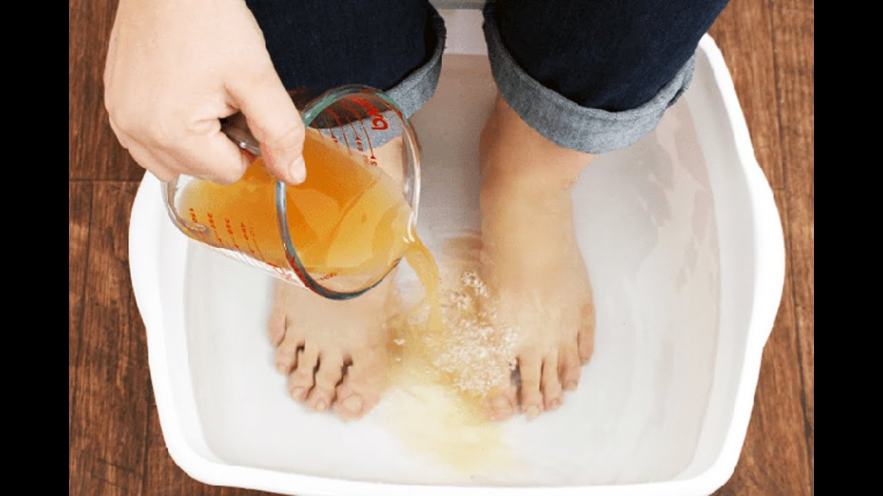 Traiter la mycose des ongles avec le bicarbonate de soude et le
