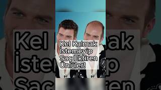 Kel Kalmak İstemeyip Saç Ektiren Ünlüler