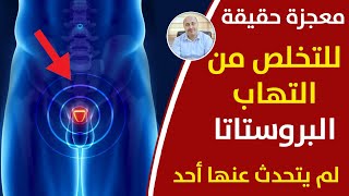 اعراض احتقان البروستاتا وعلاجها | التهاب البروستاتا المزمن وأسرع علاج لتضخم البروستاتا واعراض الكبد