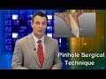 Pinhole Surgical Technique for Gum Recession: Dr. Nemeth Explains (2018)