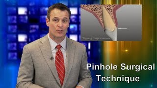 Detailed Pinhole Surgical Technique for Gum Recession: Dr. Nemeth Explains (2018) Details