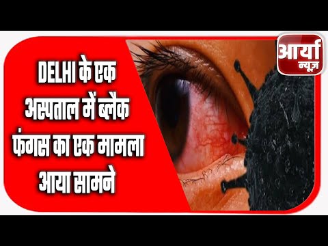 Delhi के एक अस्पताल में ब्लैक फंगस का एक मामला आया सामने | ब्लैक फंगस | Aaryaa News