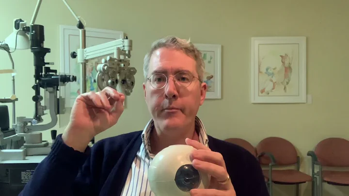 Cranial Nerve 4 Palsy Trochlear Nerve