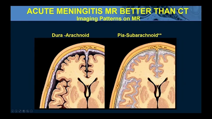 Intro to Common Causes of Intracranial Pathology, ...