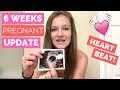 6 Week Pregnancy Update  |  HEARTBEAT Visible on Ultrasound!