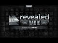 Revealed Radio 036 - Hosted by Quintino