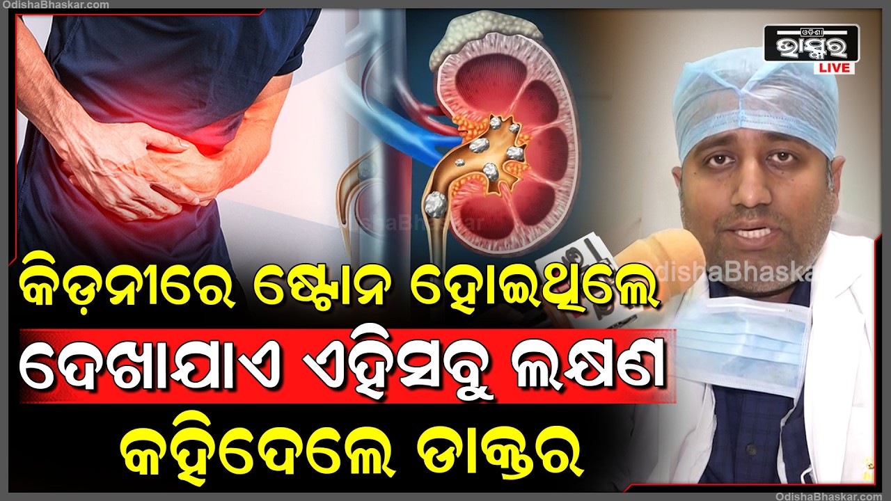 କିଡ଼ନୀରେ ଷ୍ଟୋନ ହୋଇଥିଲେ ଦେଖାଯାଏ ଏହିସବୁ ଲକ୍ଷଣ, କେମିତି କରିବେ ଚିକିତ୍ସା... କହିଦେଲେ ଡାକ୍ତର
