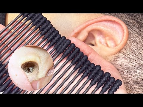 ASMR 벅벅 긁어주는🚫 진짜 시원한 귀청소 ear cleaning no talking #耳掃除