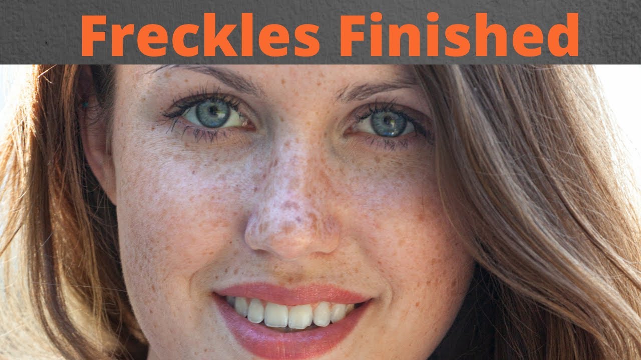 How to get rid of freckles very fast| remove freckles permanently - YouTube