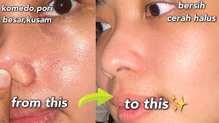 TIPS EXFOLIASI WAJAH (STEP BY STEP) | KUNCI KULIT KINCLONG✨BEBAS KOMEDO  KUSAM