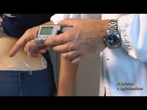 Diabete di Tipo 1: microinfusori e sensori per un miglior controllo della malattia