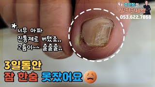 잠못드게 하는 발톱 케어 #발 #발톱 #내성발톱 #무좀발톱 #대구내성발톱