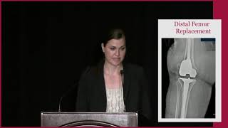 Case Study: Periprosthetic Fractures of Knee