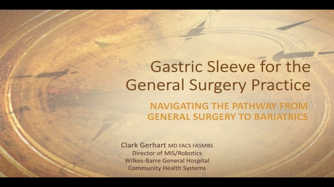 Robotic Sleeve Gastrectomy by Clark Gerhart MD, FACS, FASMBS YouTube