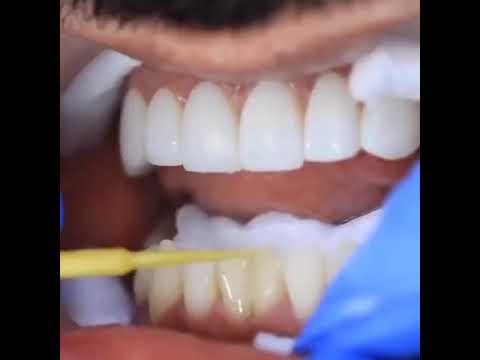 Video: 4 եղանակ, երբ լավ ատամնաբուժական խնամքը կարող է բարելավել ձեր շան ատամները