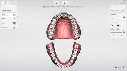 3Shape  - Lab custom order form creation for TRIOS