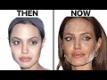Angelina jolie new face  plastic surgery analysis