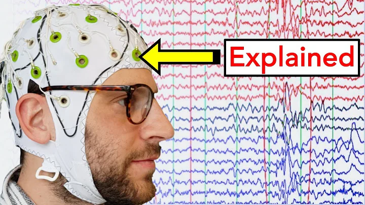 EEG (Electroencephalogram) Explained
