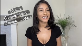 MY 6 MONTH UPDATE 🍒 | Breast Augmentation Pros and Cons | Libby, xo