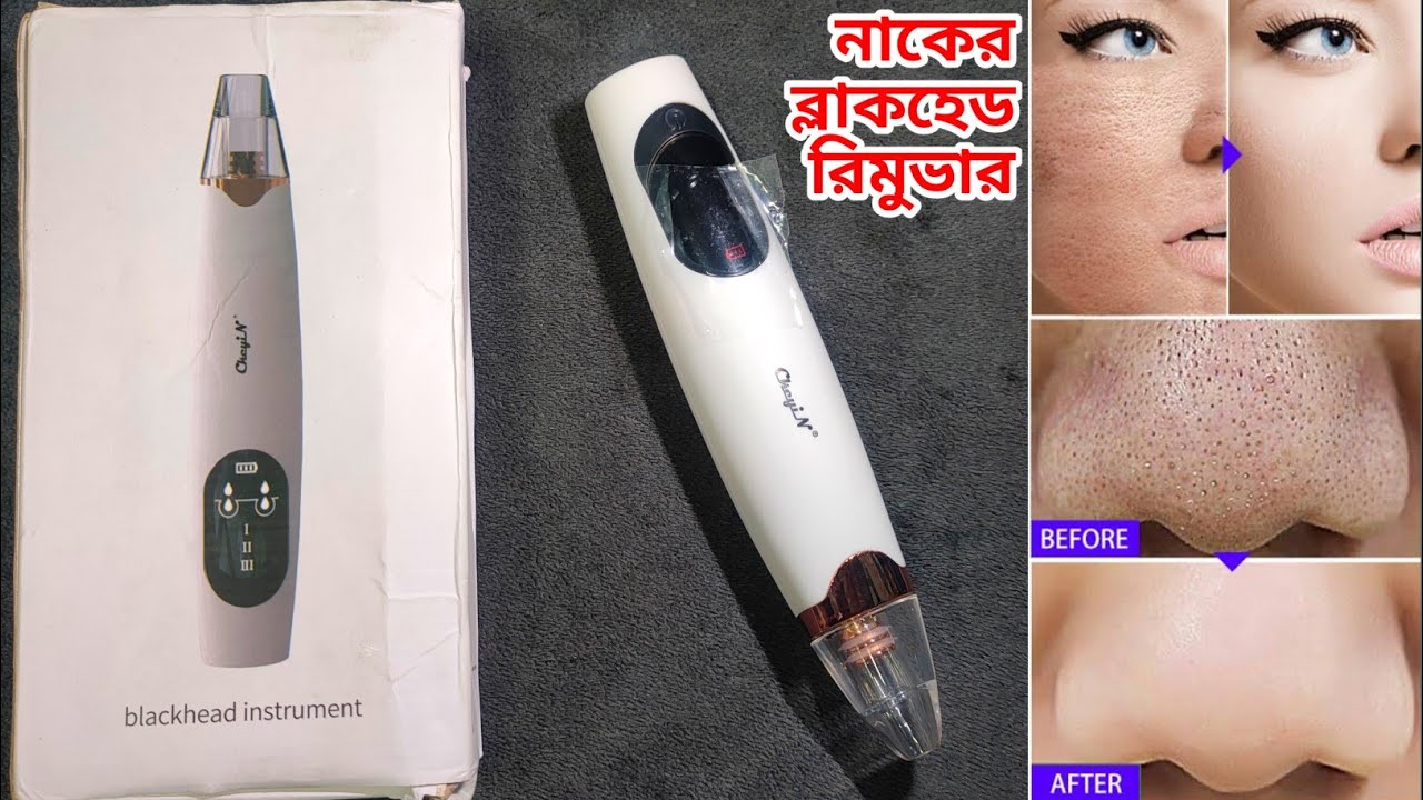 নাকের ব্লাকহেড রিমুভার মেশিন রিভিউ। Blackhead Remover Machine