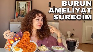 AMELİYATTAN SONRAKİ İLK VİDEOM! YENİ BEN | HEPİMİZE GEÇMİŞ OLSUN 🙏🏻