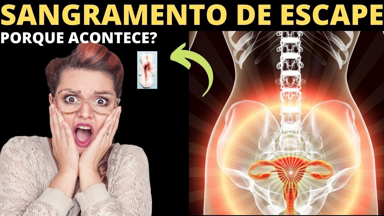 Sangramento Fora Do Periodo Menstrual Tomando Anticoncepcional YouTube Sangramento Fora Do Periodo Menstrual Tomando Anticoncepcional YouTube