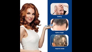 Alopecia Hair Growth Cream 100% Proven & Effective Solution