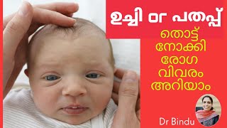 ഉച്ചി താഴ്ന്നിരുന്നാൽ/ ഉയർന്നിരുന്നാൽ/വലുപ്പം കൂടിയാൽ/Baby's fontanelle or soft spots/Dr Bindu screenshot 3