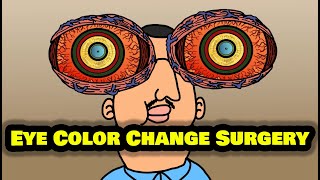 Eye Color Change Surgery