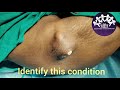 Identify this condition