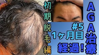 初期脱毛 Youtube