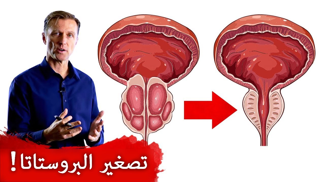أوقفوا البروستاتا من التضخم اليوم | الحفاظ على صحة البروستات