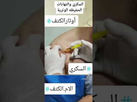 السكري والتهاب أوتار الكتف