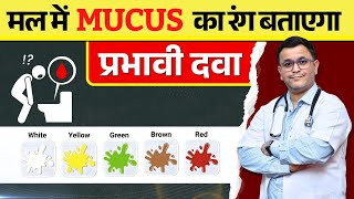मल या STOOL में MUCUS रोकने की 3 BEST homeopathic medicine screenshot 5