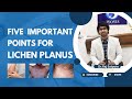 5 tips for lichen planus you must never forget  lichen planus treatment