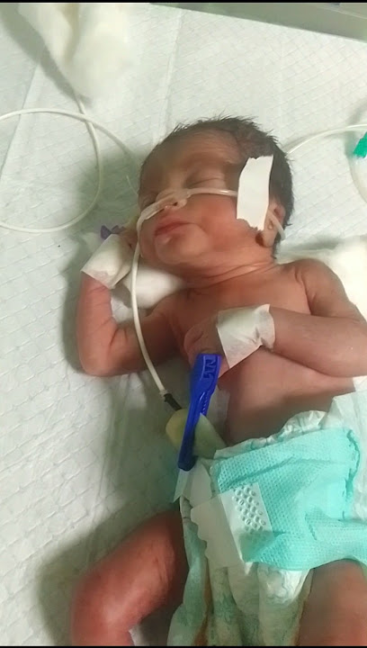 Preterm Baby NICU Admitted ll Baby  Wt: 1.3kg  #viralvideo#pretermbaby #trendingshorts #youtubevideo
