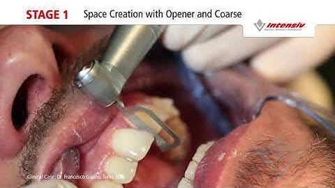 Intensiv Swingle Intensiv Ortho Strips