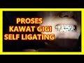 Proses kawat gigi self ligating murah jakarta indonesia