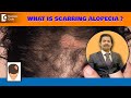 6 causes why no hair growth after hair treatmentscarring alopeciadrdeepak devakardoctors circle