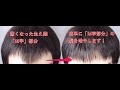 生え際両サイドの髪が薄い「M字ハゲ」復活！「貼る増毛」で簡単に髪を蘇らせる。【薄毛対策】