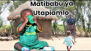 BMG TV: Zaidi ya watoto 1,000 watibiwa utapiamlo mkoani Mara
