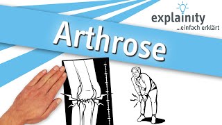 Arthrose einfach erklärt (explainity® Erklärvideo)