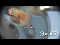 Rimozione della guttaperca in un ritrattamento endodontico. Dr. Andrea Balocco SHAPE IT